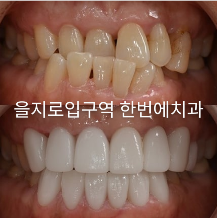 한번에치과의원 명동 대표 이미지