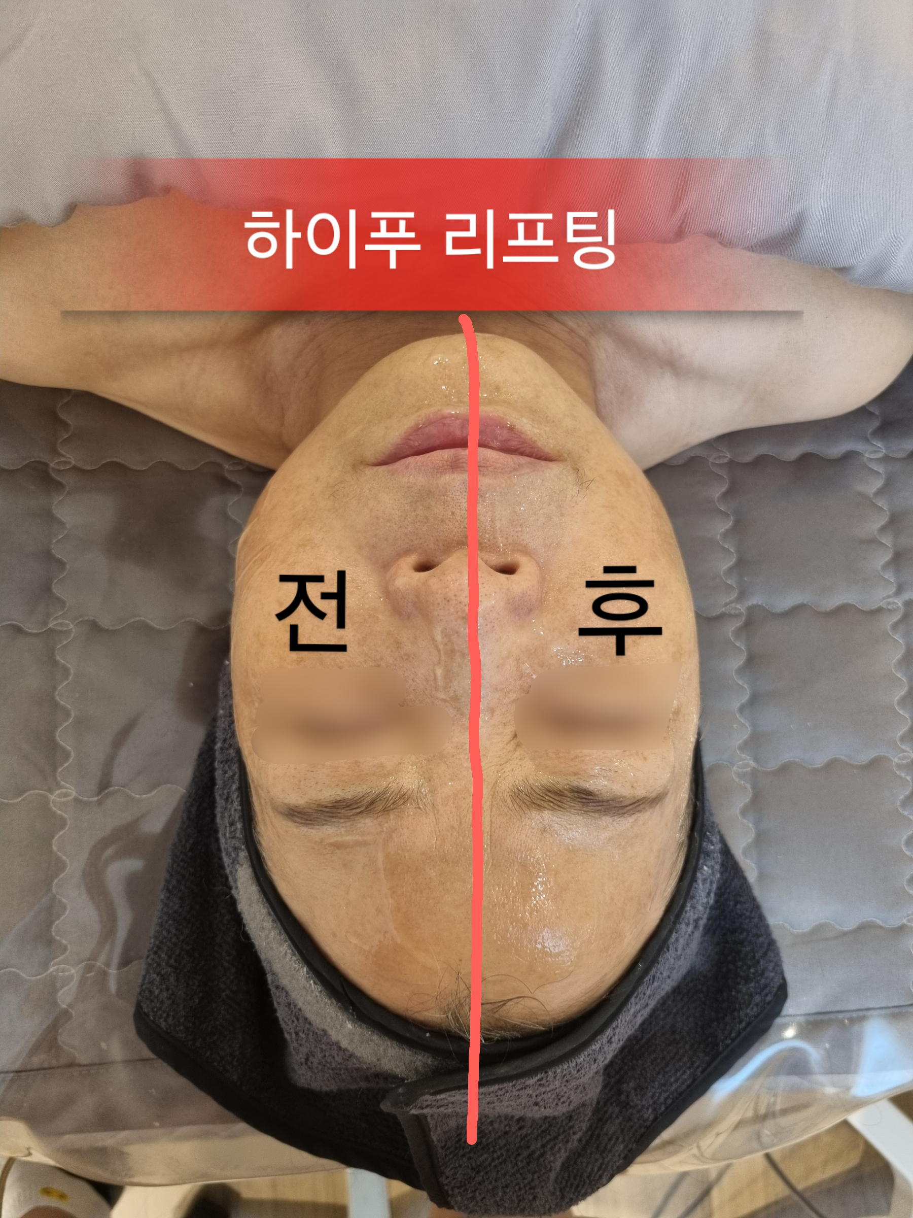 올에이지스킨케어 대표 이미지