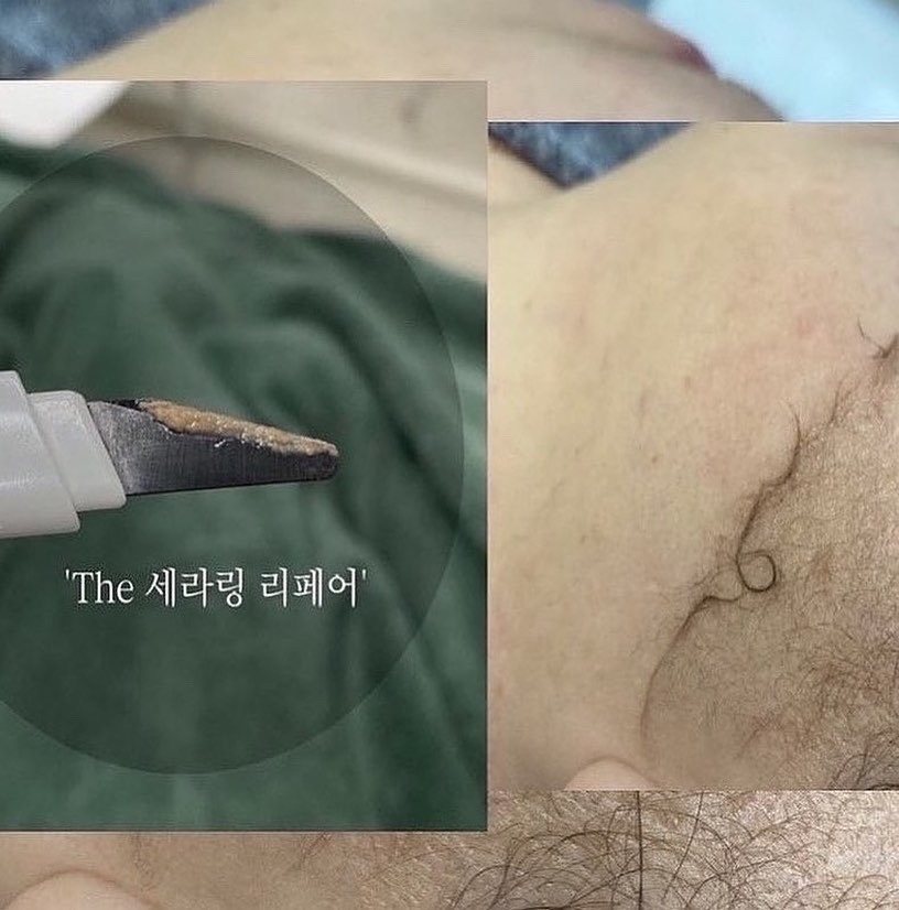 휘브로 대표 이미지