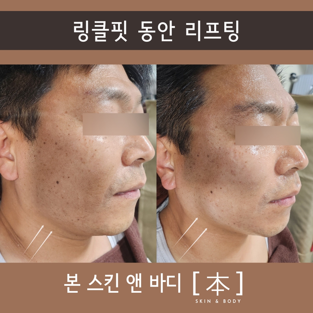 본스킨앤바디 대표 이미지
