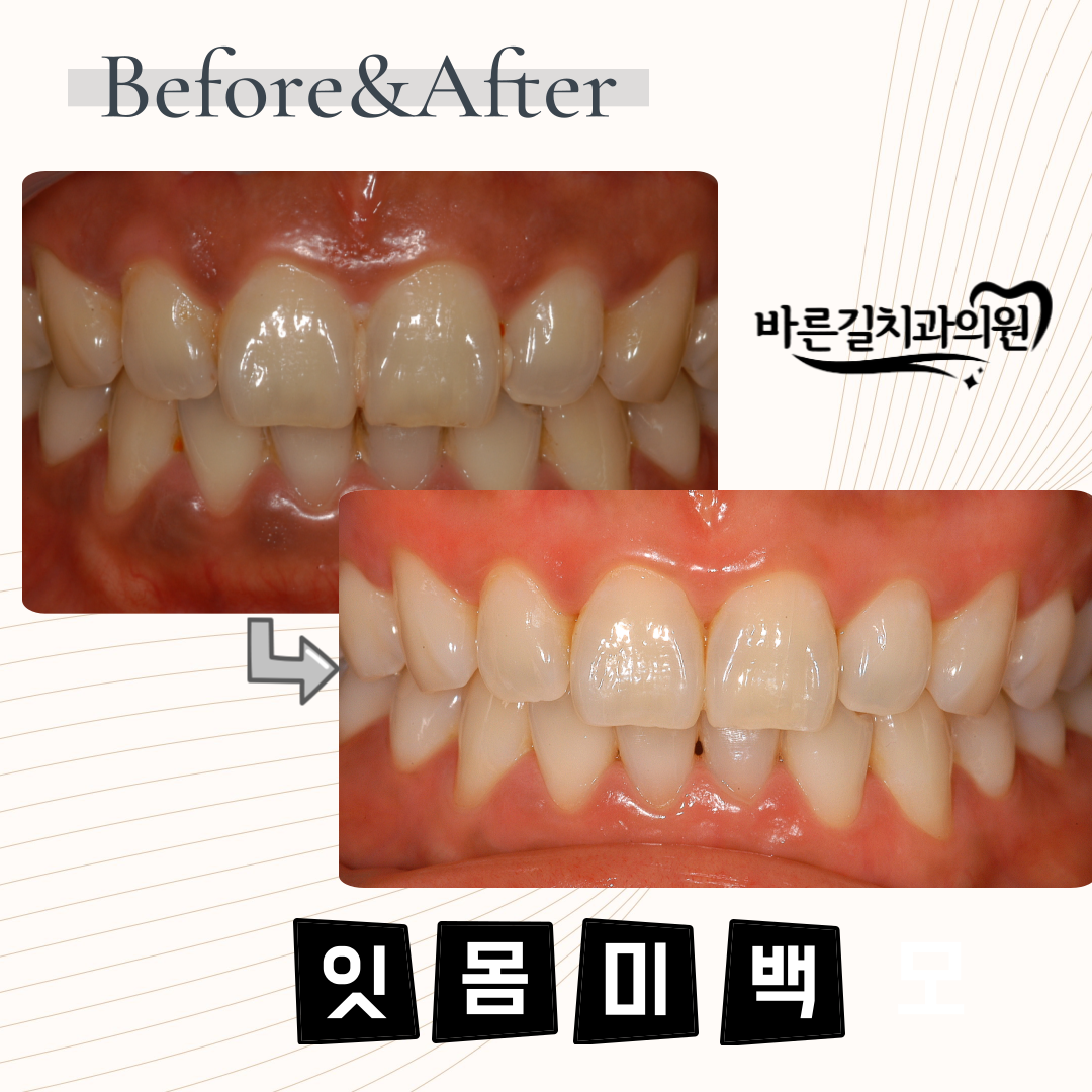 바른길치과의원 대표 이미지