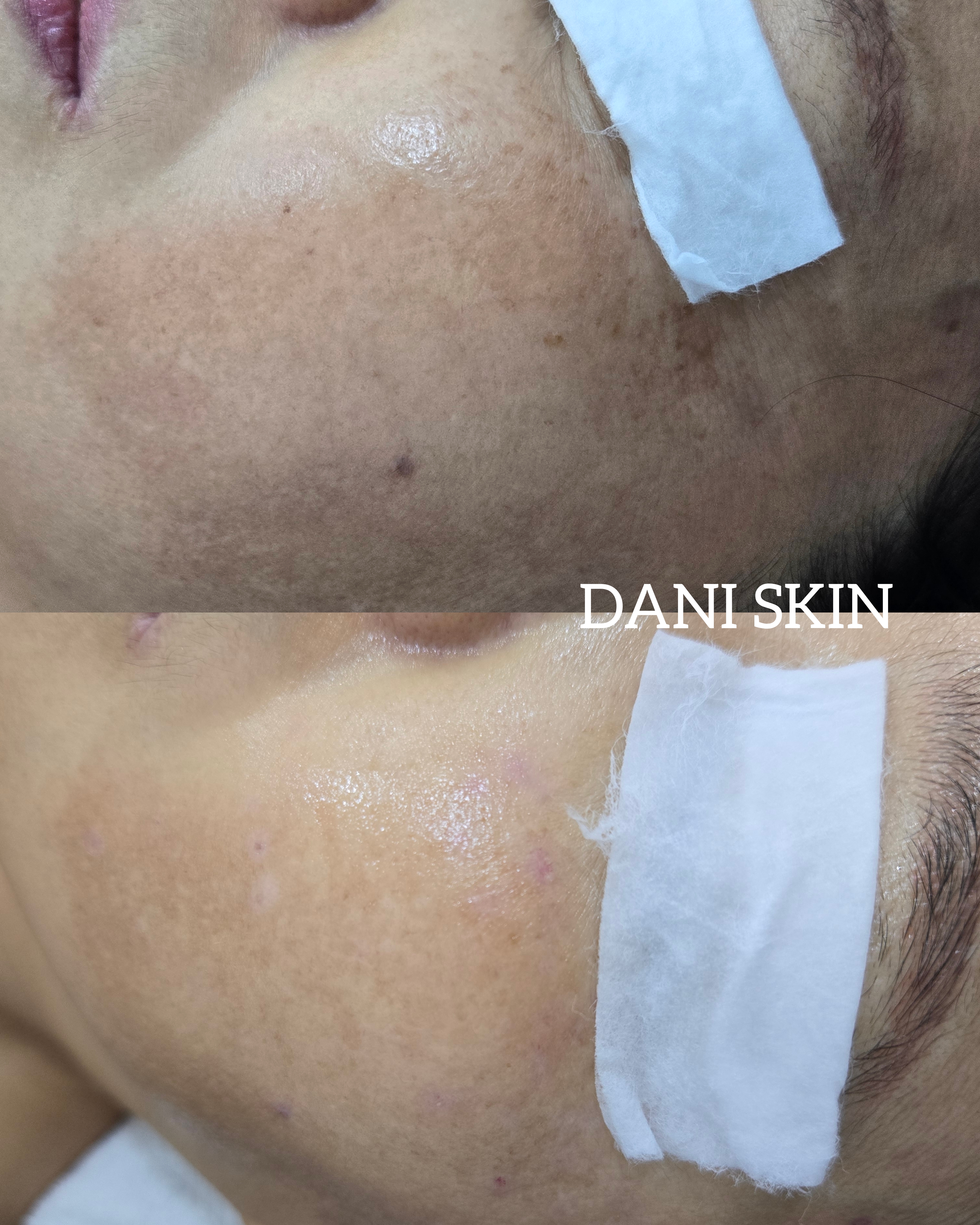 다니스킨 대표 이미지