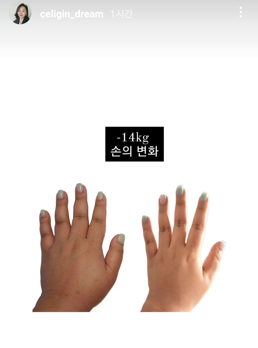 셀포랩 아리핏 photo 4