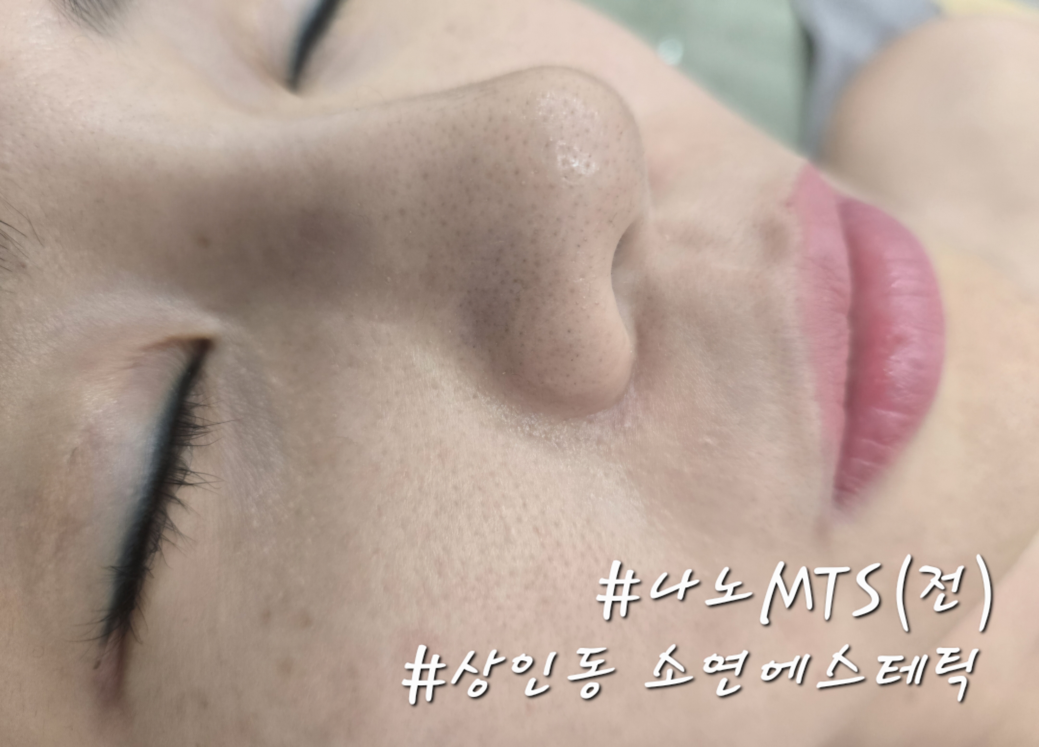 소연에스테틱 상인점