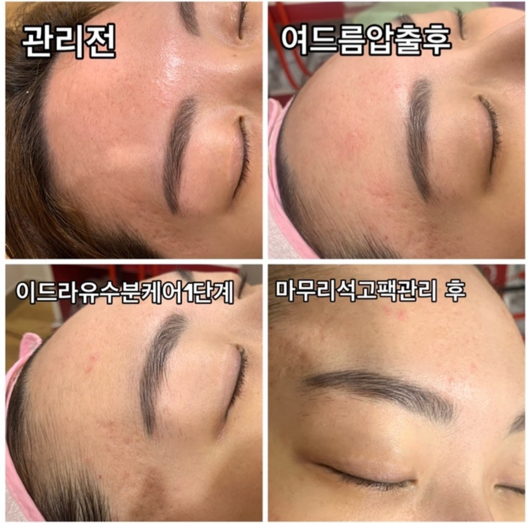 소연에스테틱 상인점