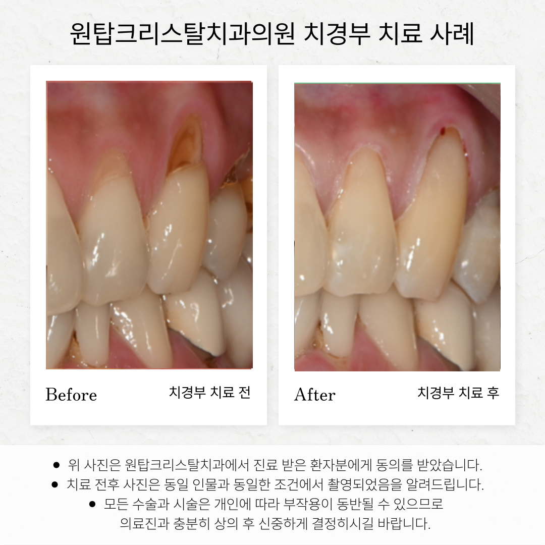 원탑크리스탈치과의원 대표 이미지