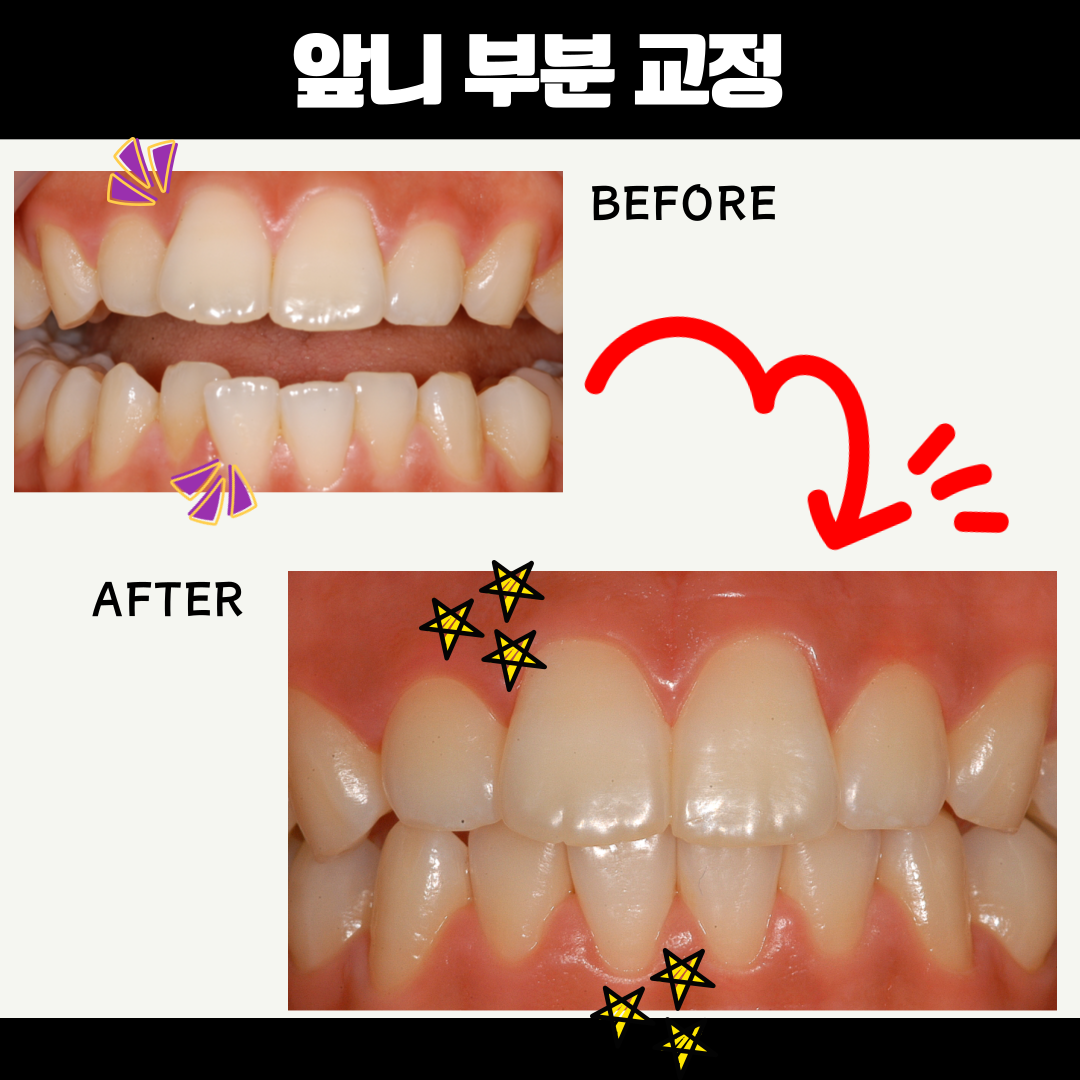 바른길치과의원 대표 이미지