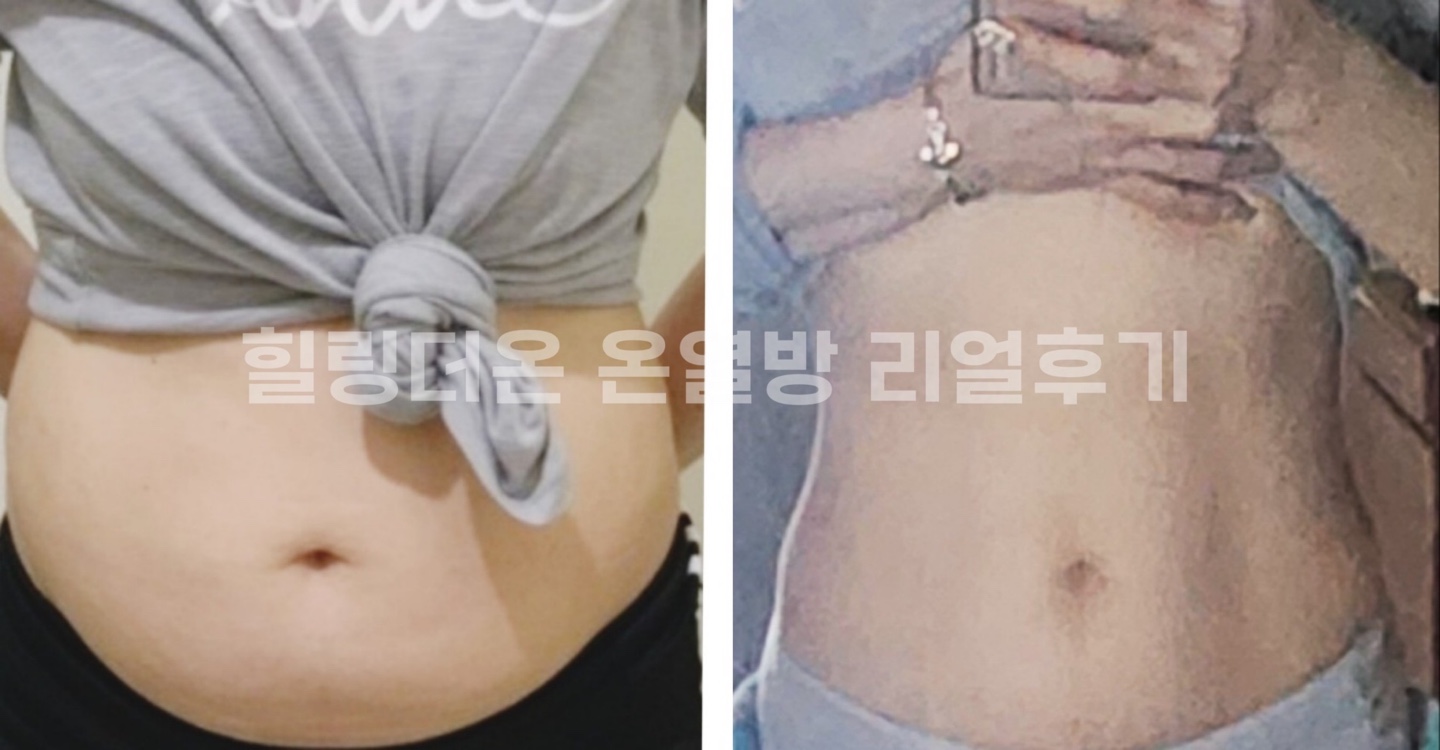 힐링더온 온열다이어트