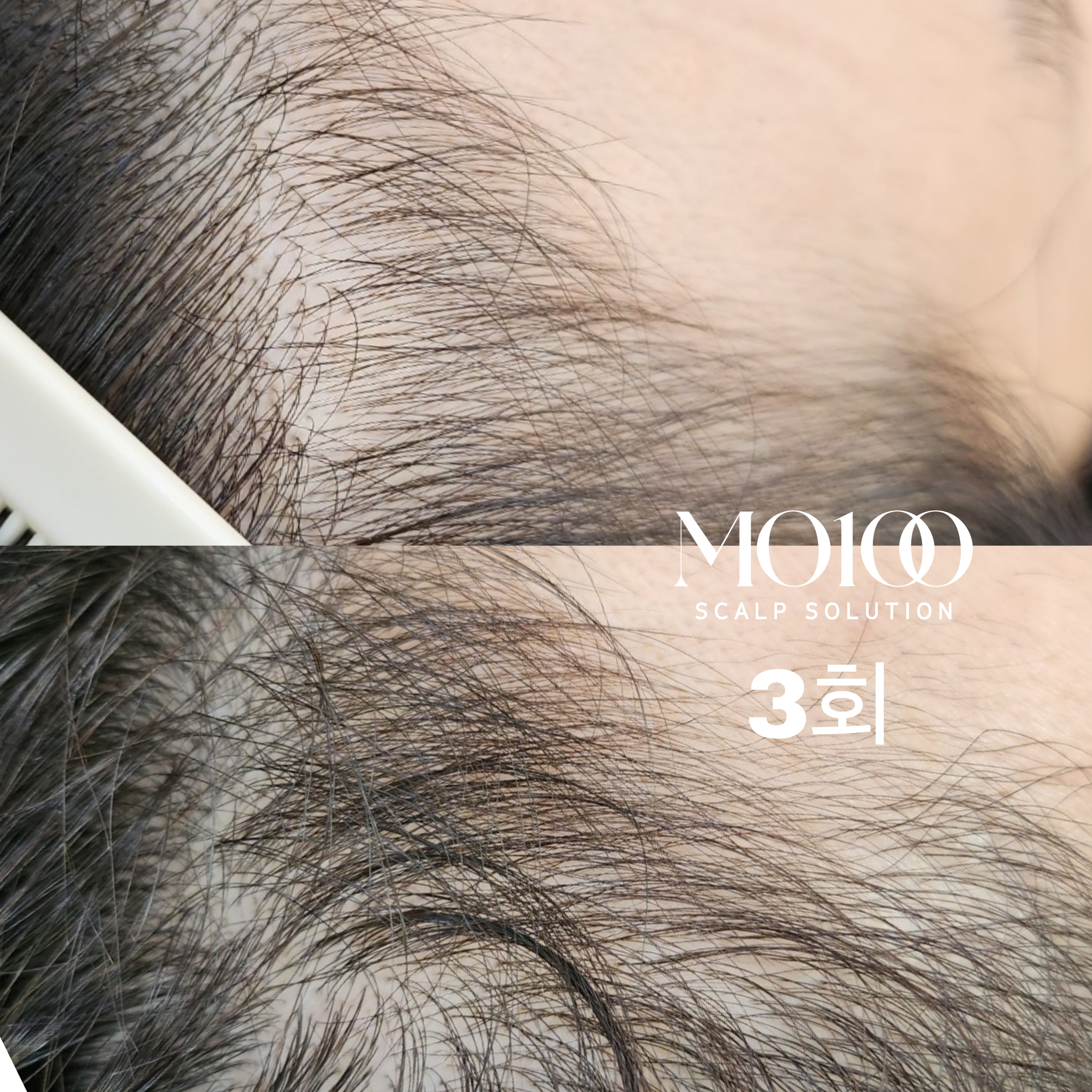 하티미미 대표 이미지