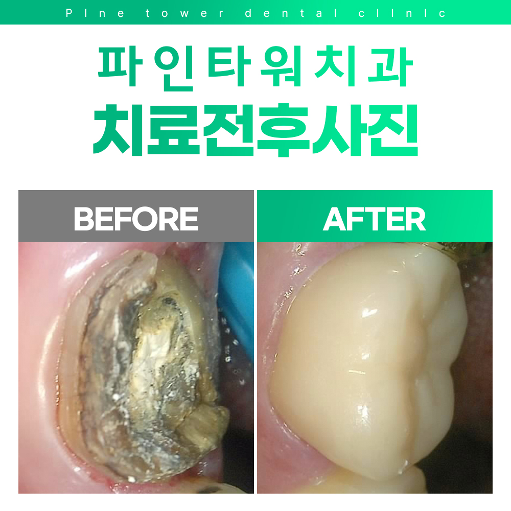 파인타워치과의원 대표 이미지