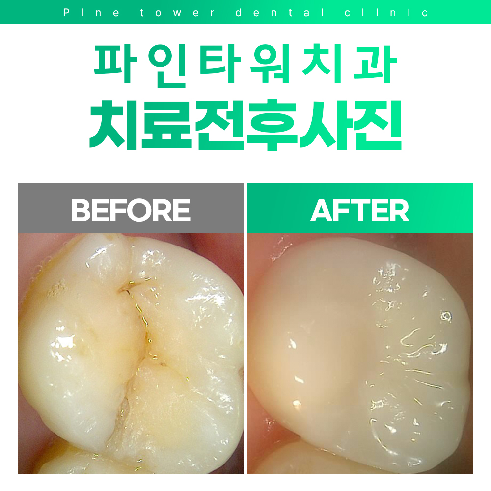 파인타워치과의원 대표 이미지