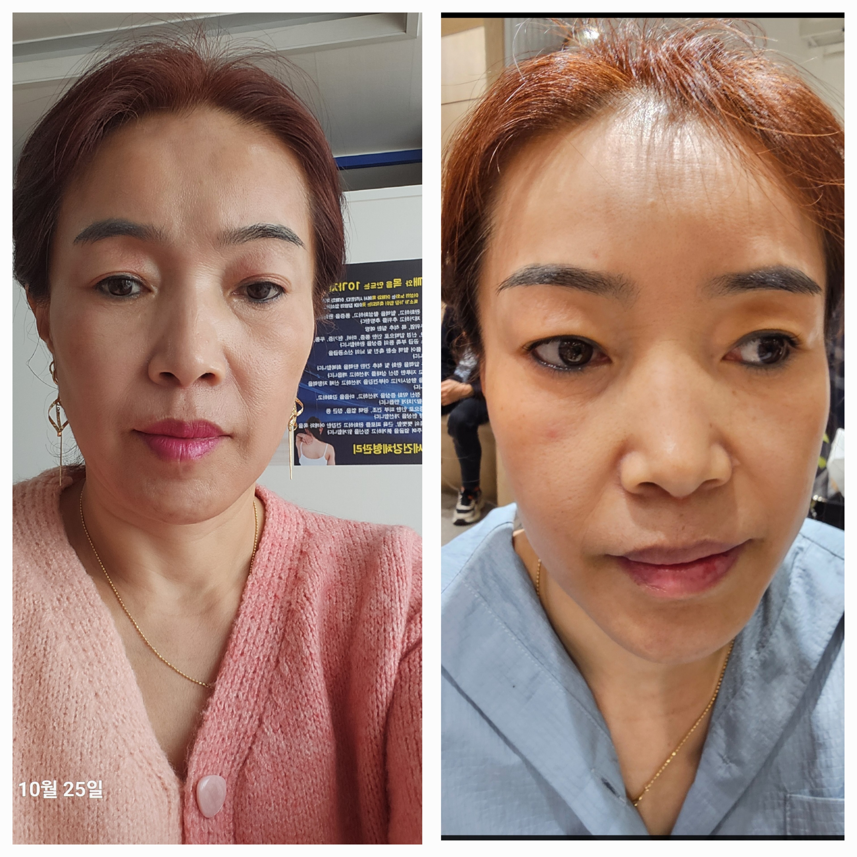백세건강체형관리