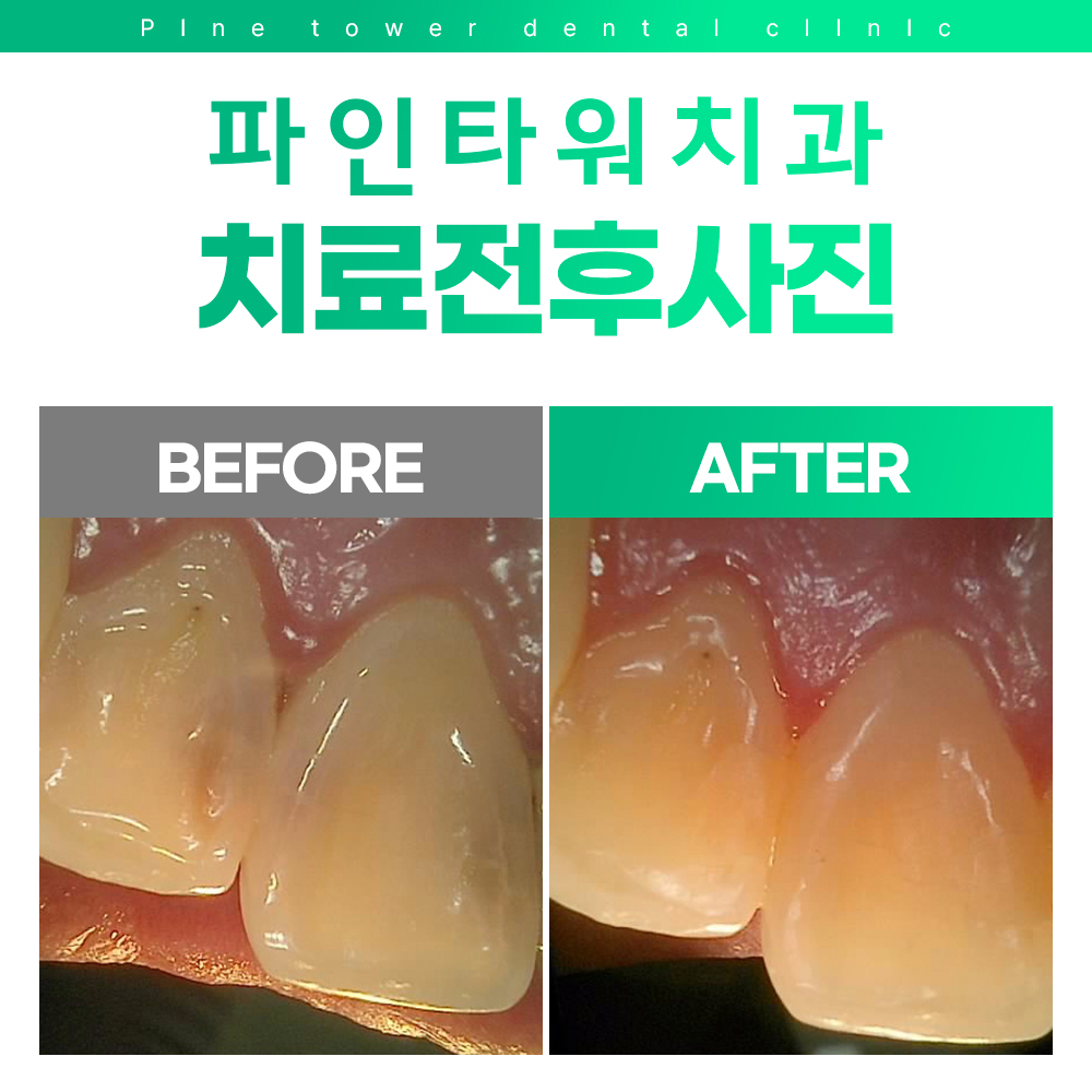 파인타워치과의원 대표 이미지