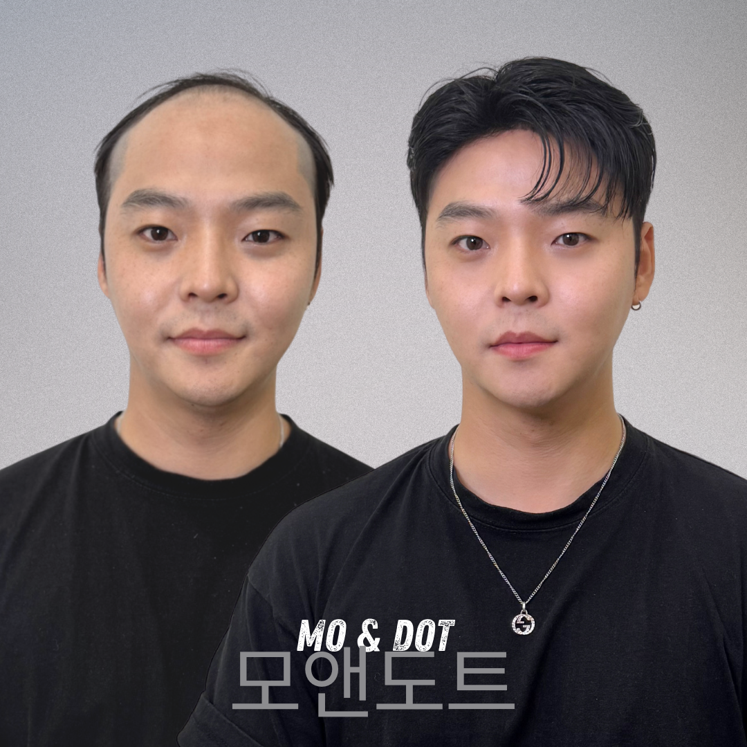 모앤도트