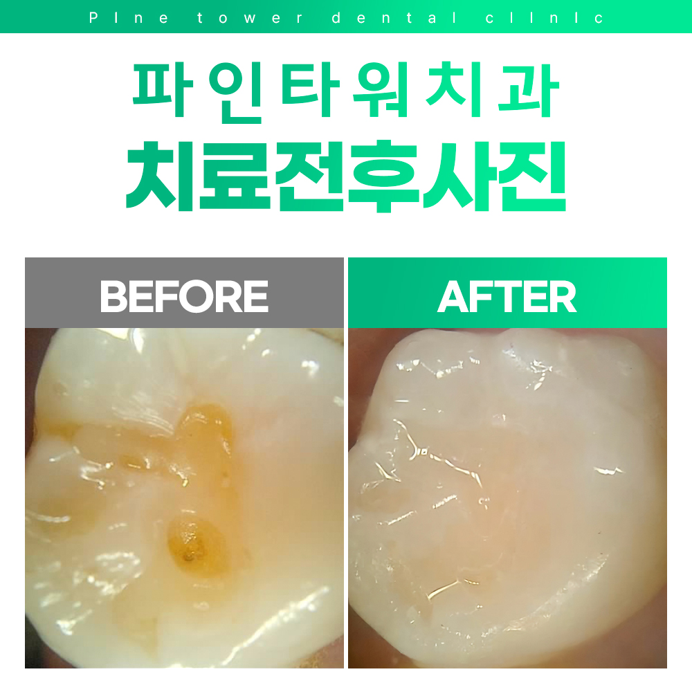 파인타워치과의원 대표 이미지