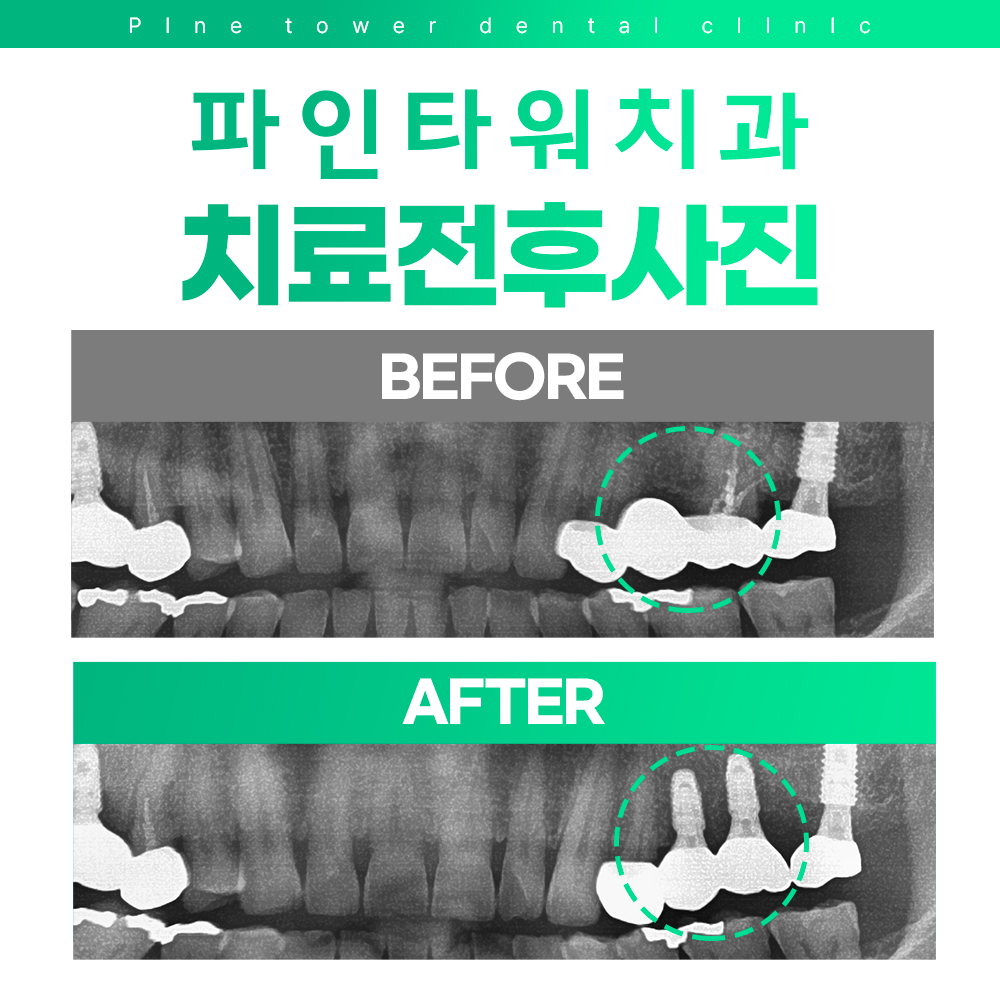 파인타워치과의원 대표 이미지