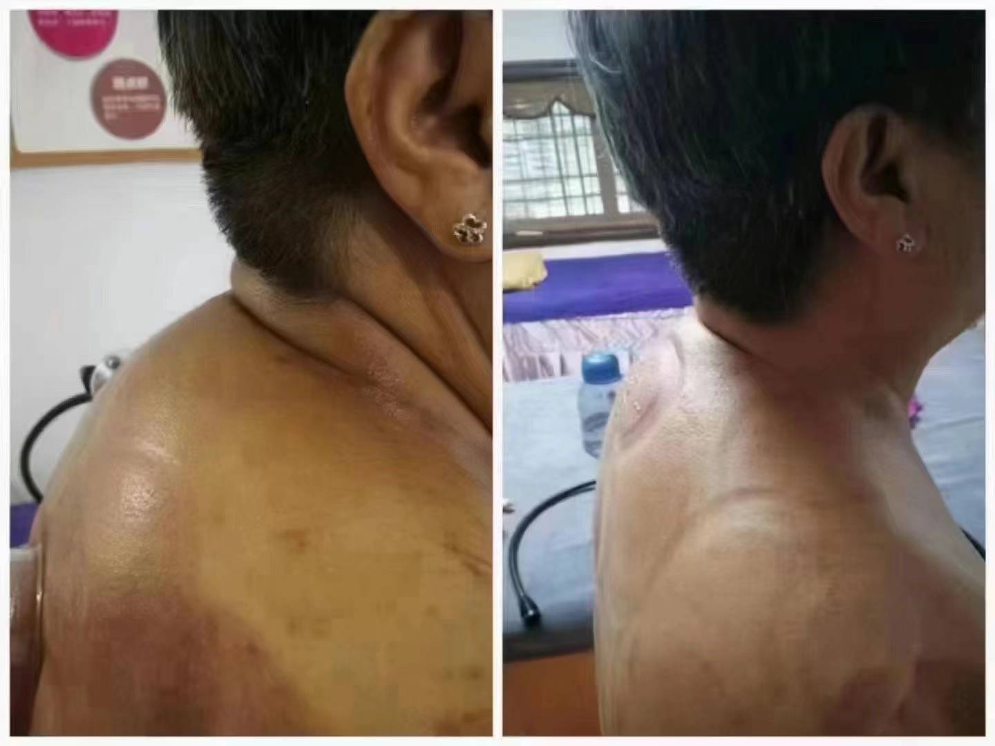 백세건강체형관리
