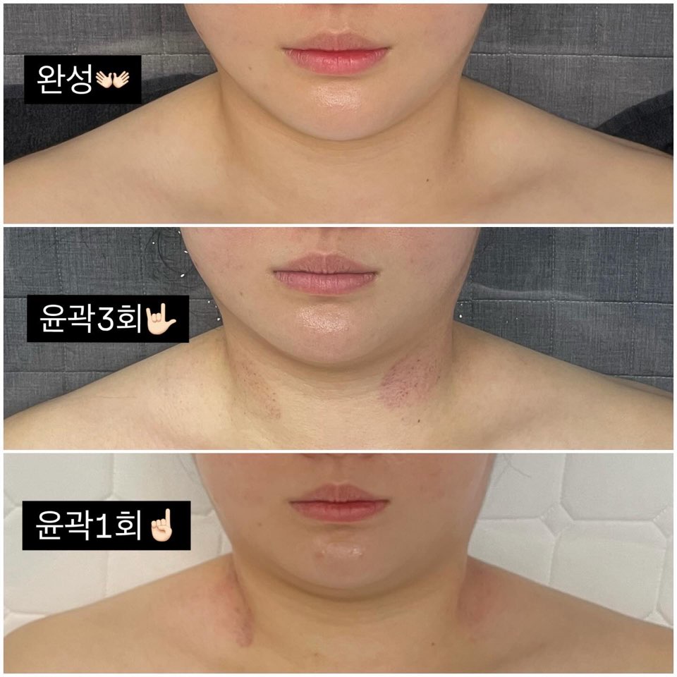 바름바디케어
