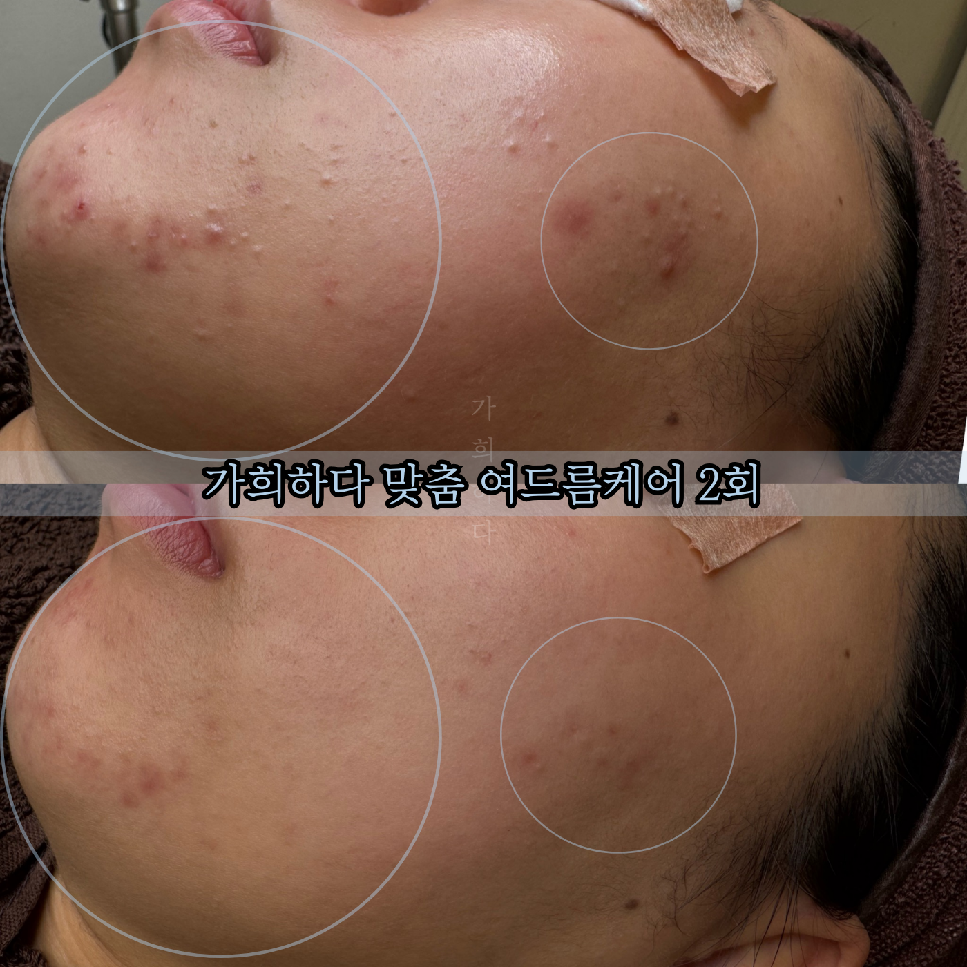 가희하다 잠실 대표 이미지