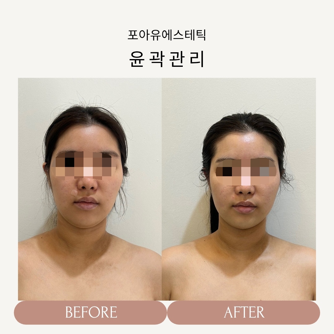 포아유에스테틱 대표 이미지