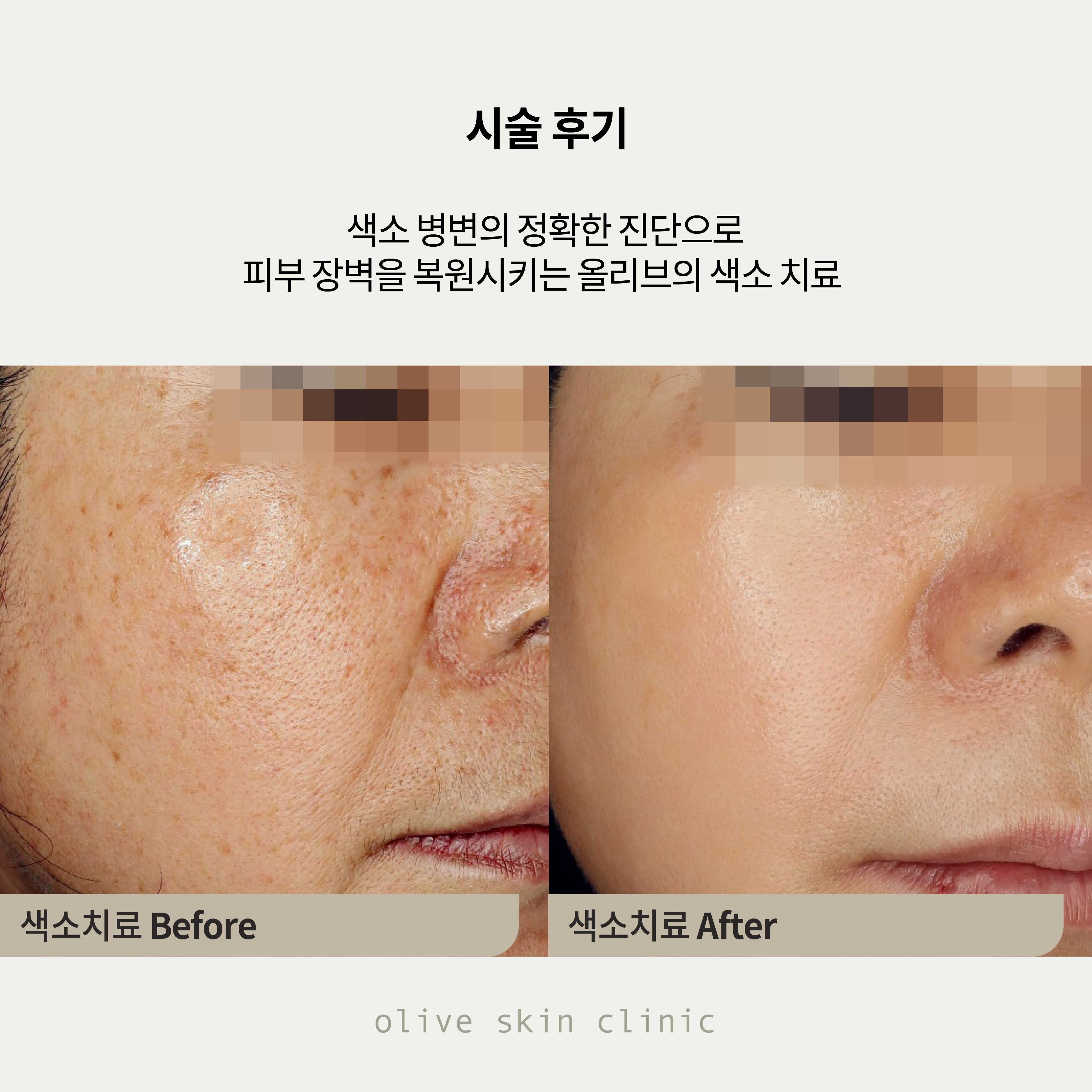 올리브피부과의원 대표 이미지