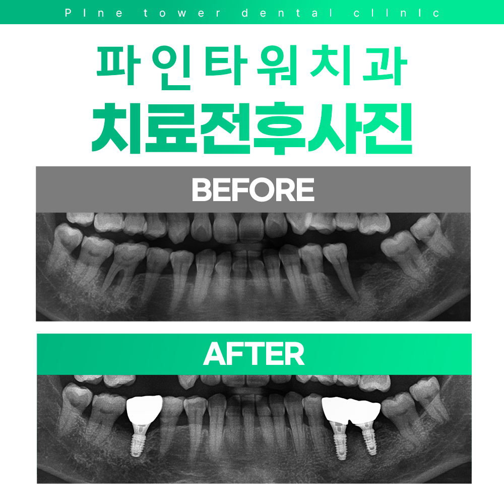 파인타워치과의원 대표 이미지