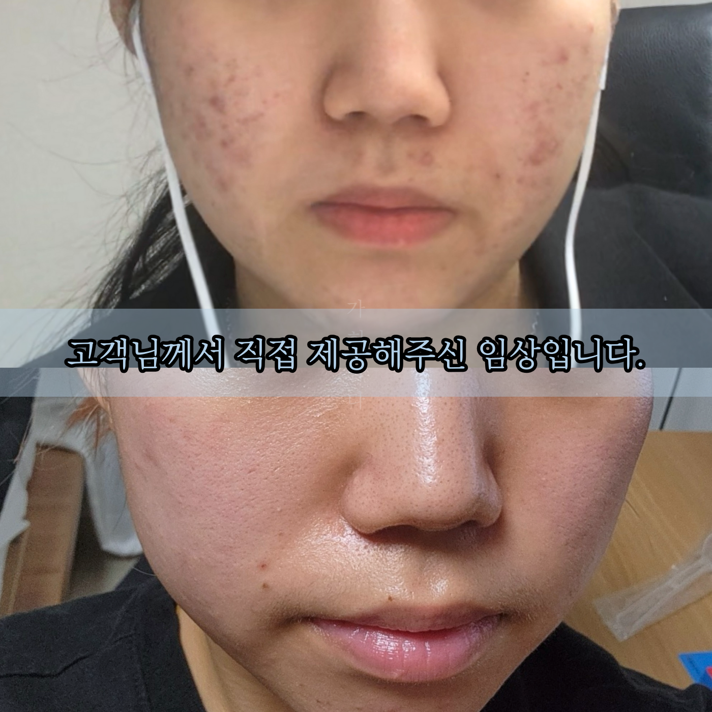 가희하다 대표 이미지