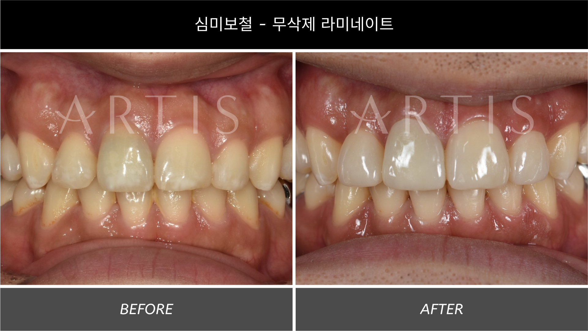 아티스치과의원 왕십리 대표 이미지