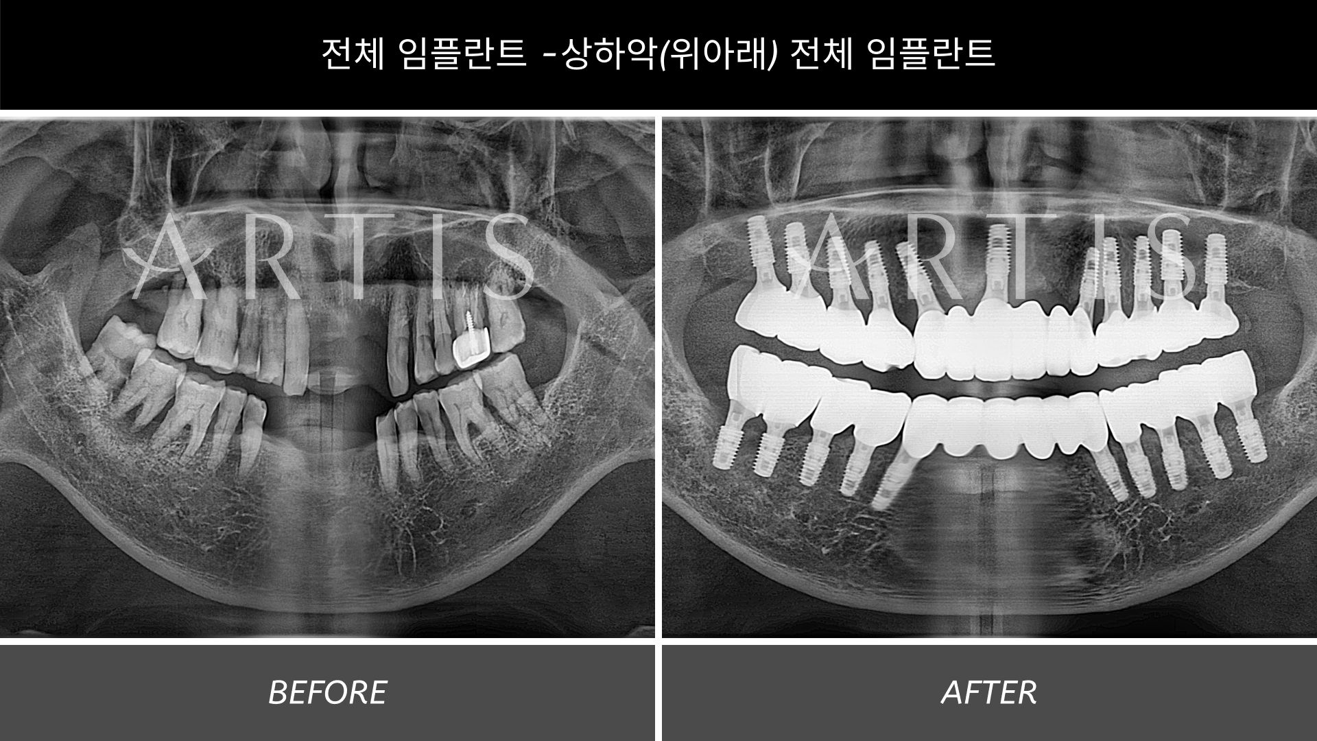 아티스치과의원 왕십리 대표 이미지
