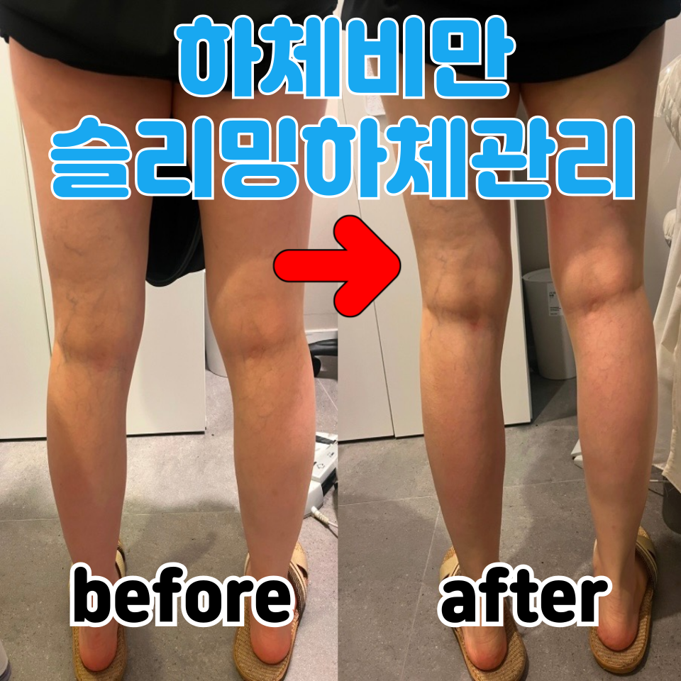 리프트스킨케어 마곡피부관리 대표 이미지