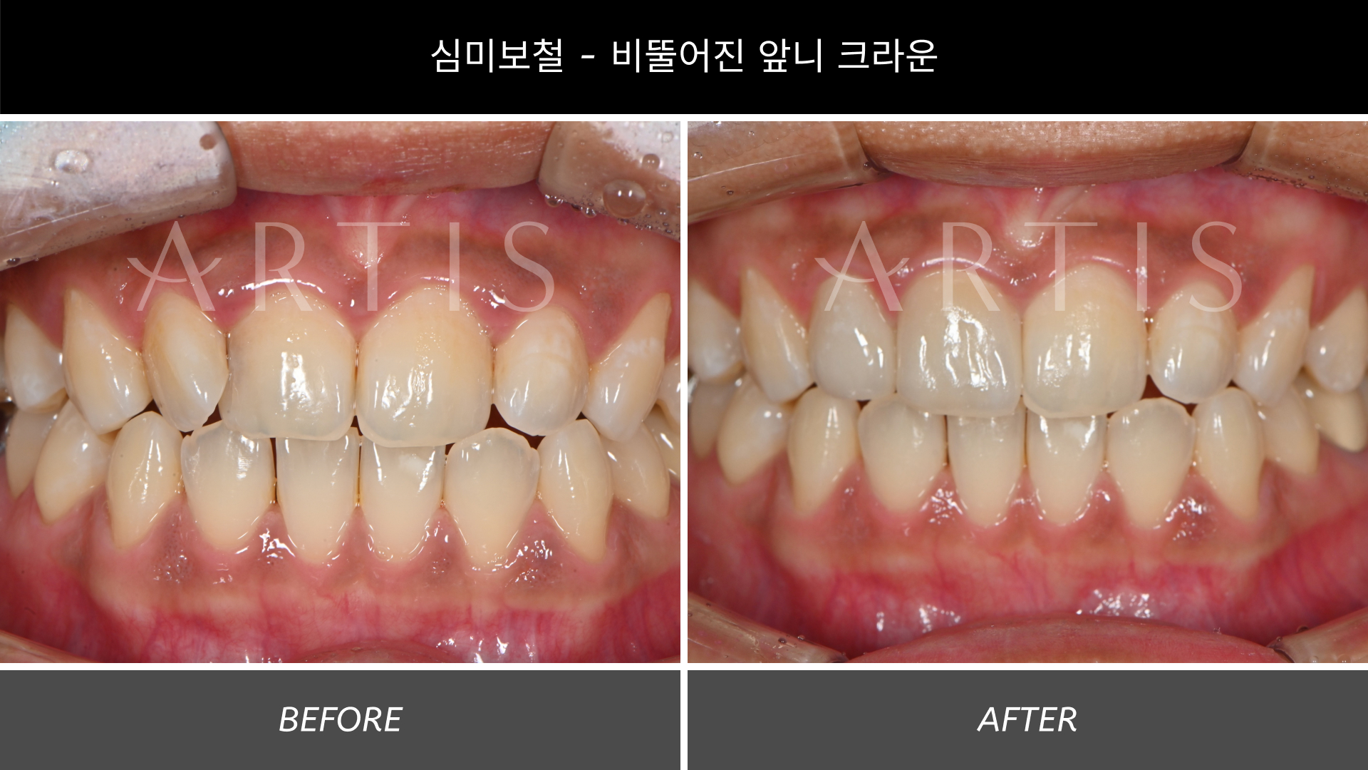 아티스치과의원 왕십리 대표 이미지