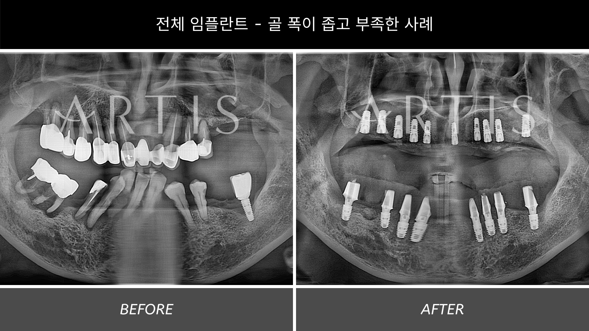 아티스치과의원 왕십리 대표 이미지