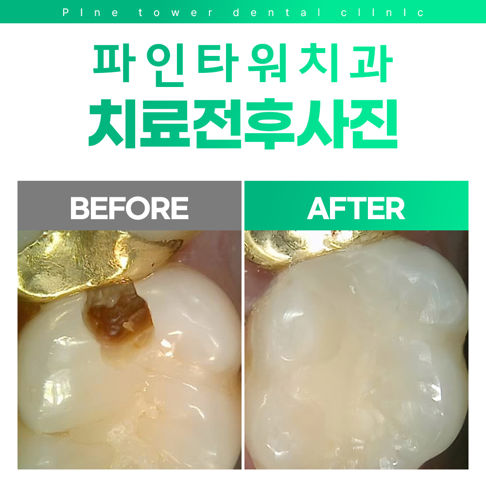 파인타워치과의원 대표 이미지