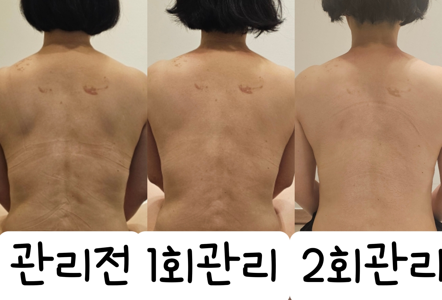 채움에스테틱