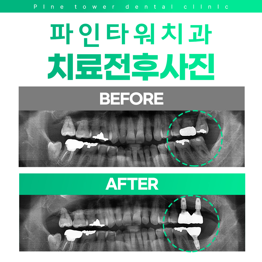 파인타워치과의원 대표 이미지