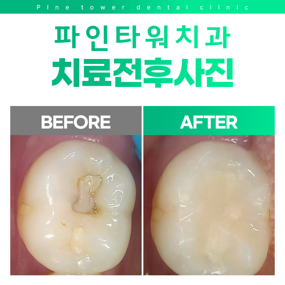 파인타워치과 대표 이미지