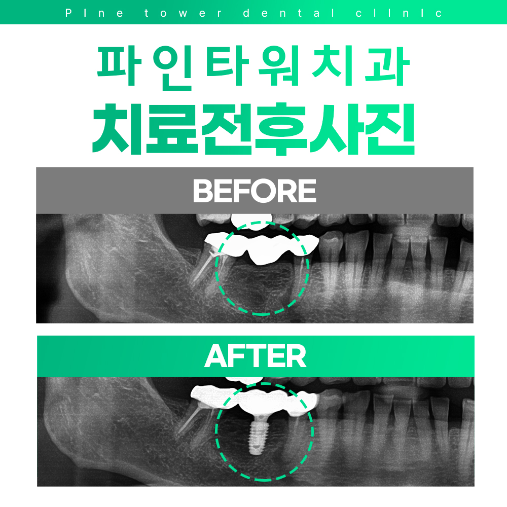 파인타워치과의원 대표 이미지