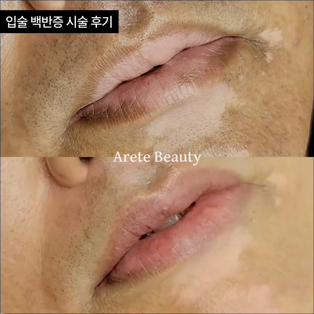 나르샤