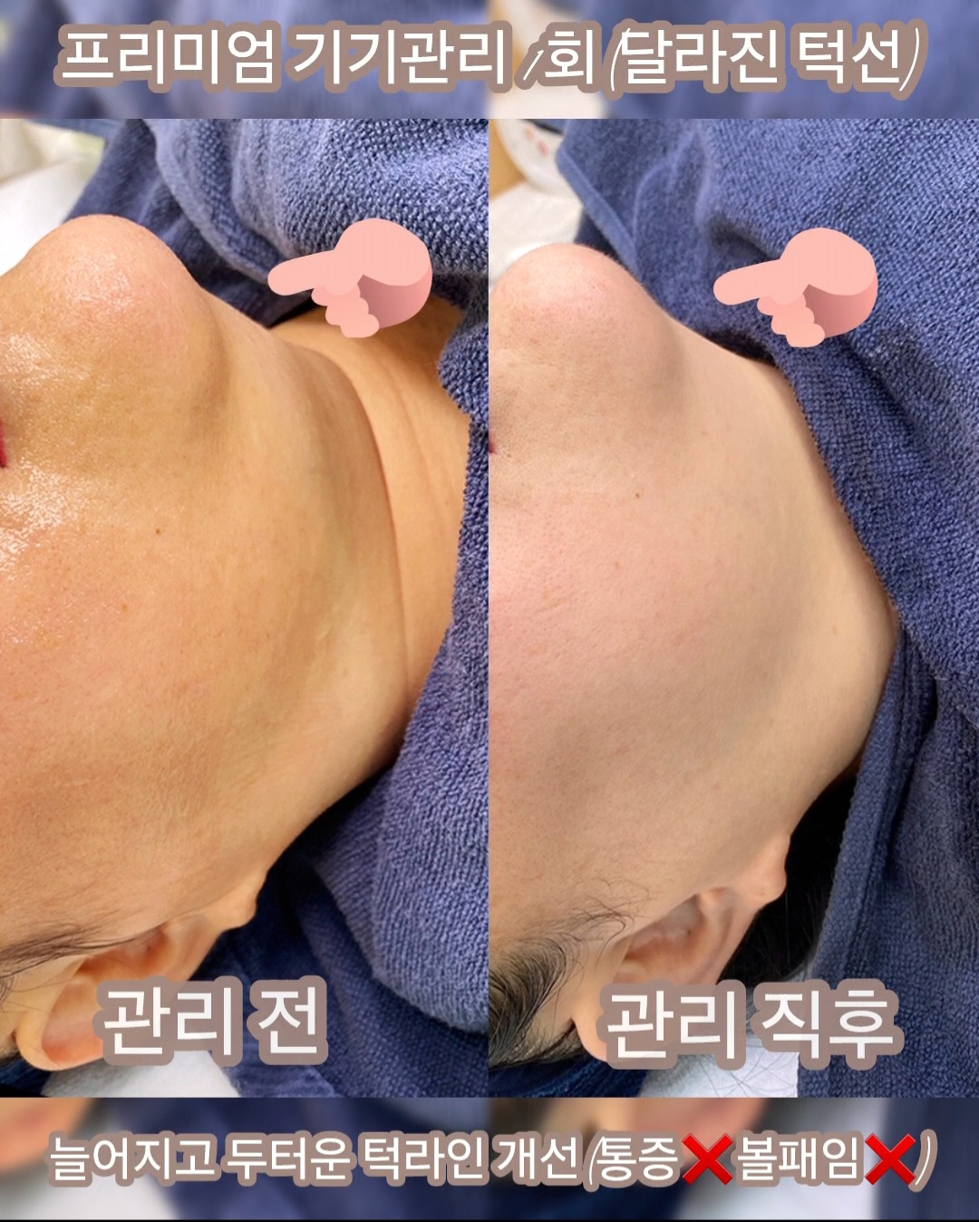 프레쉬브로우 대표 이미지