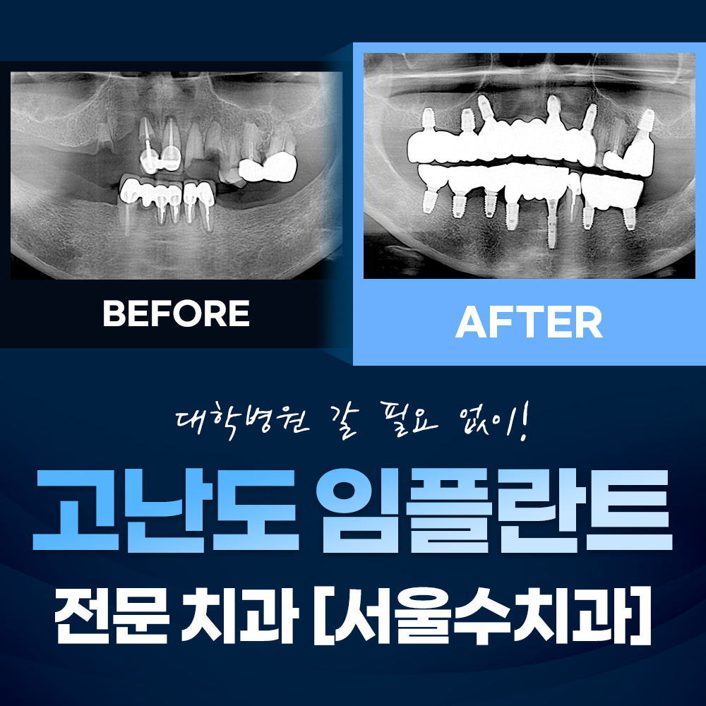 서울수치과의원 대표 이미지