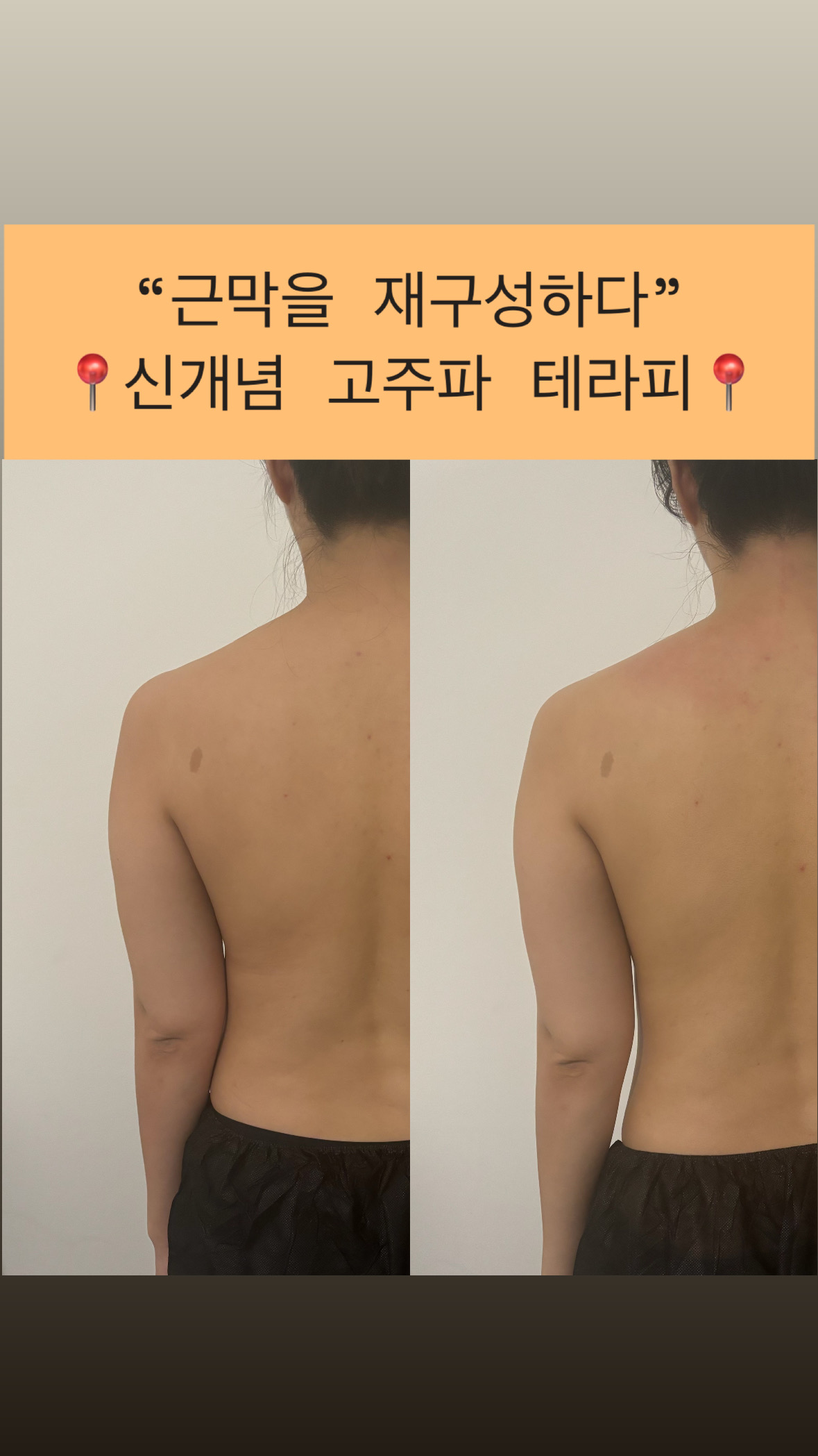 이프로움 photo 7