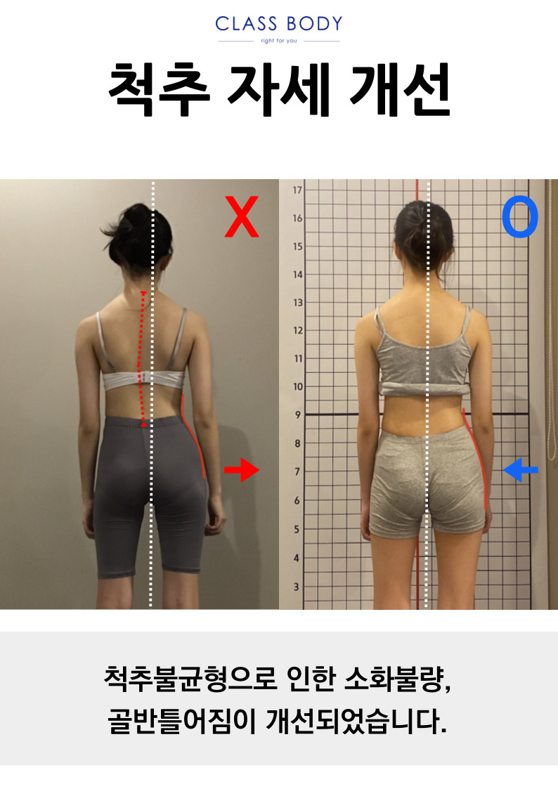 클래스바디 체형교정센터 분당서현점 photo 10