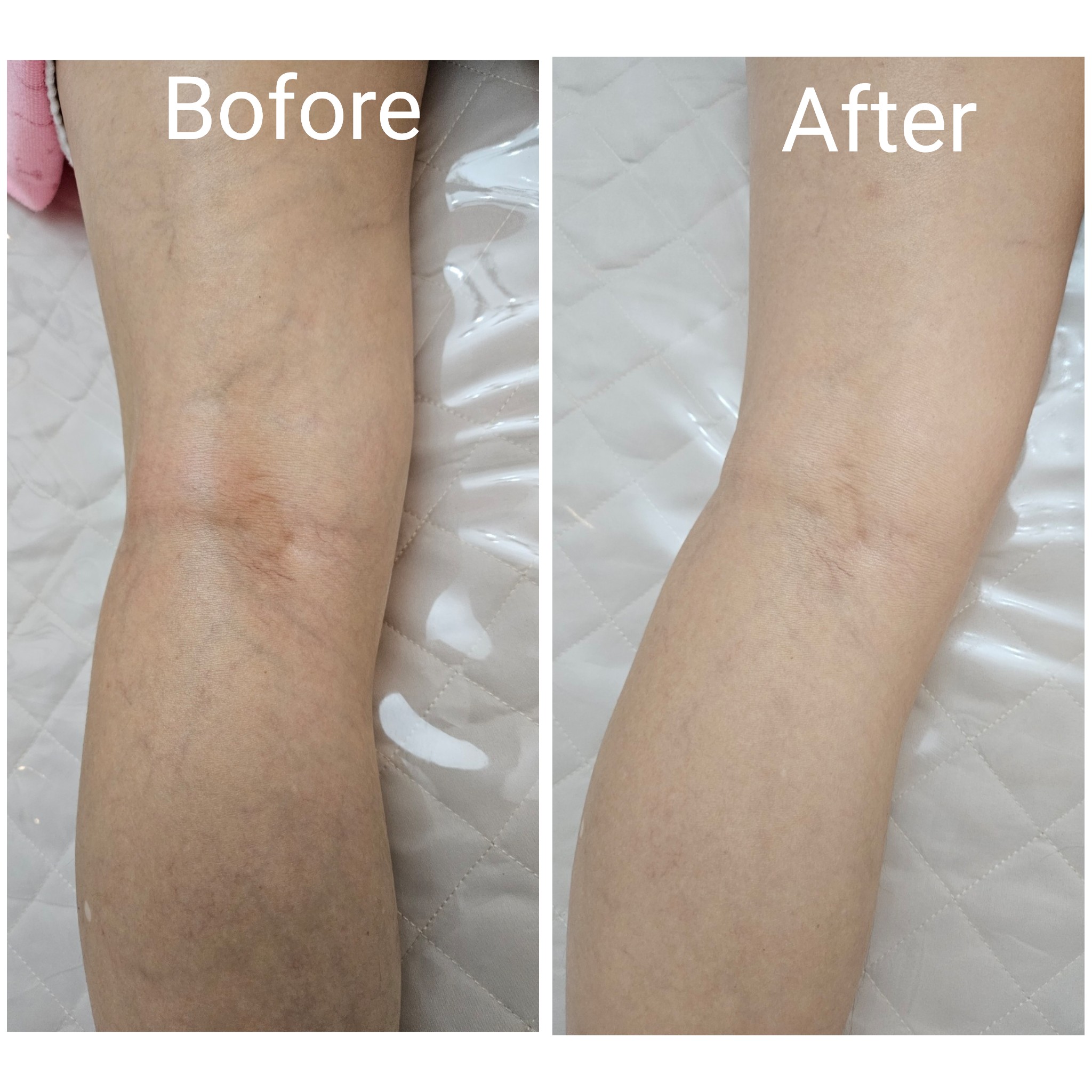 드고아by에끌라 대표 이미지