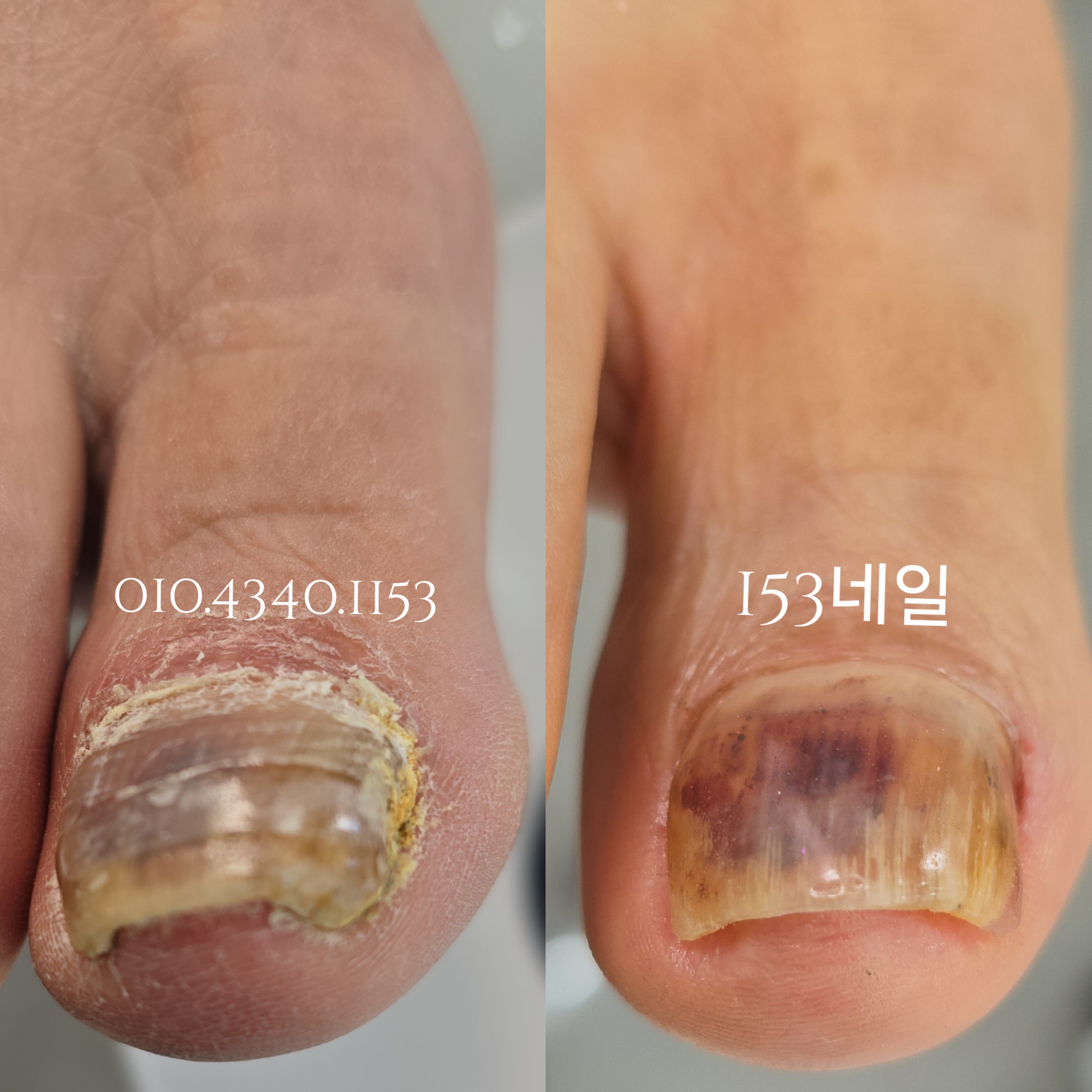 153네일 대표 이미지