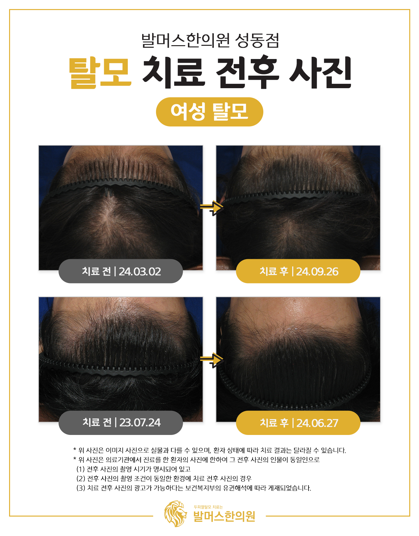 발머스한의원 종로성동 대표 이미지