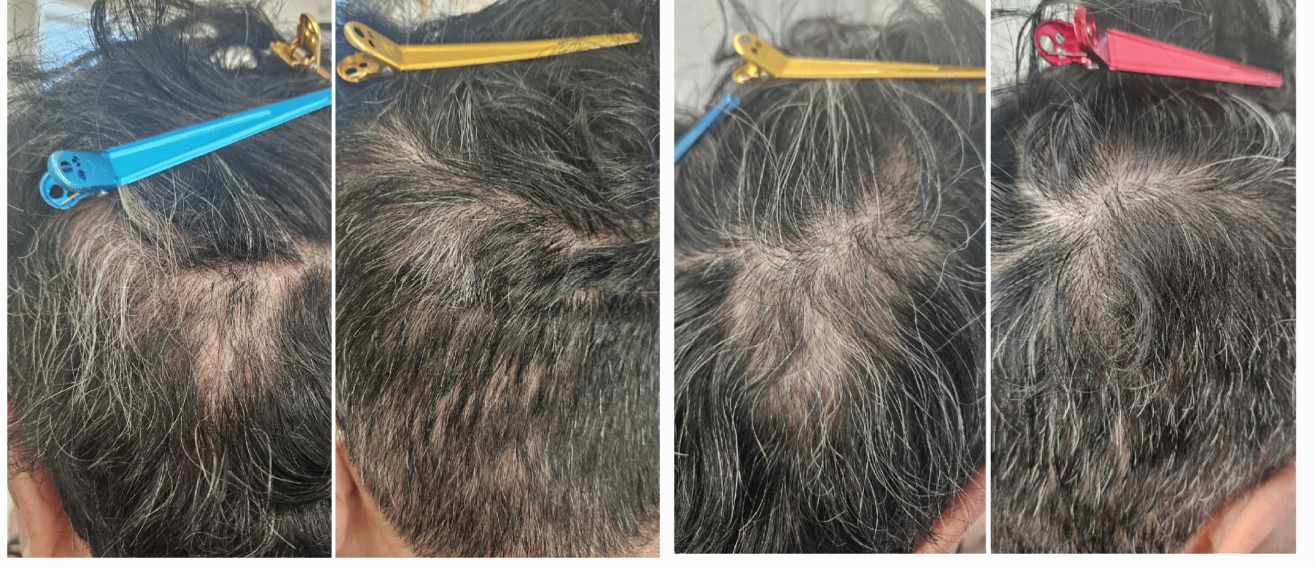 미모에스테틱 대표 이미지