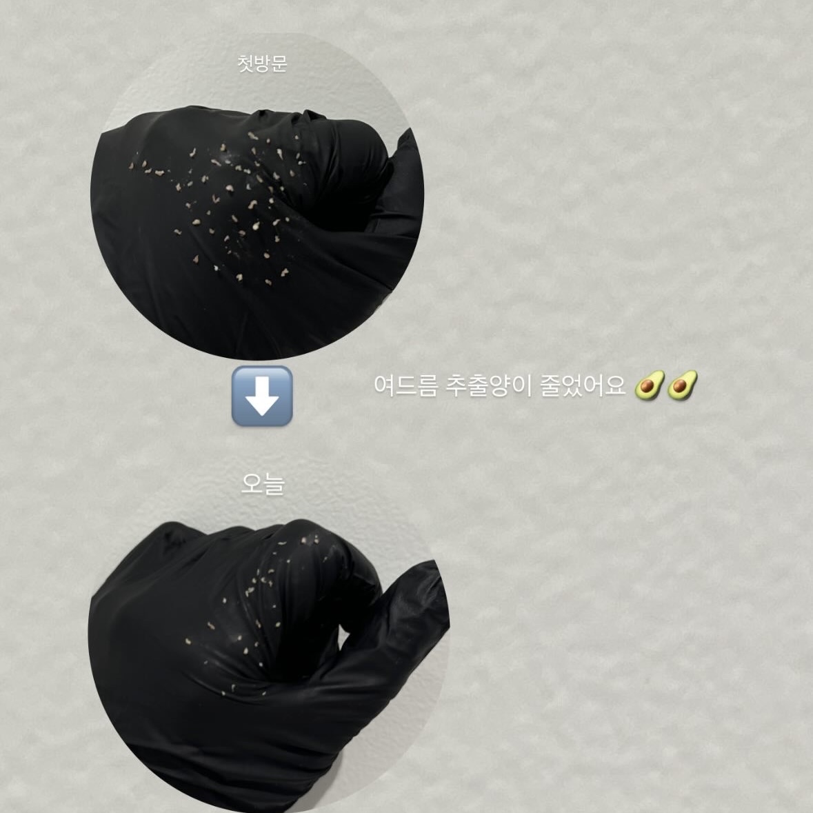 아보르스킨케어