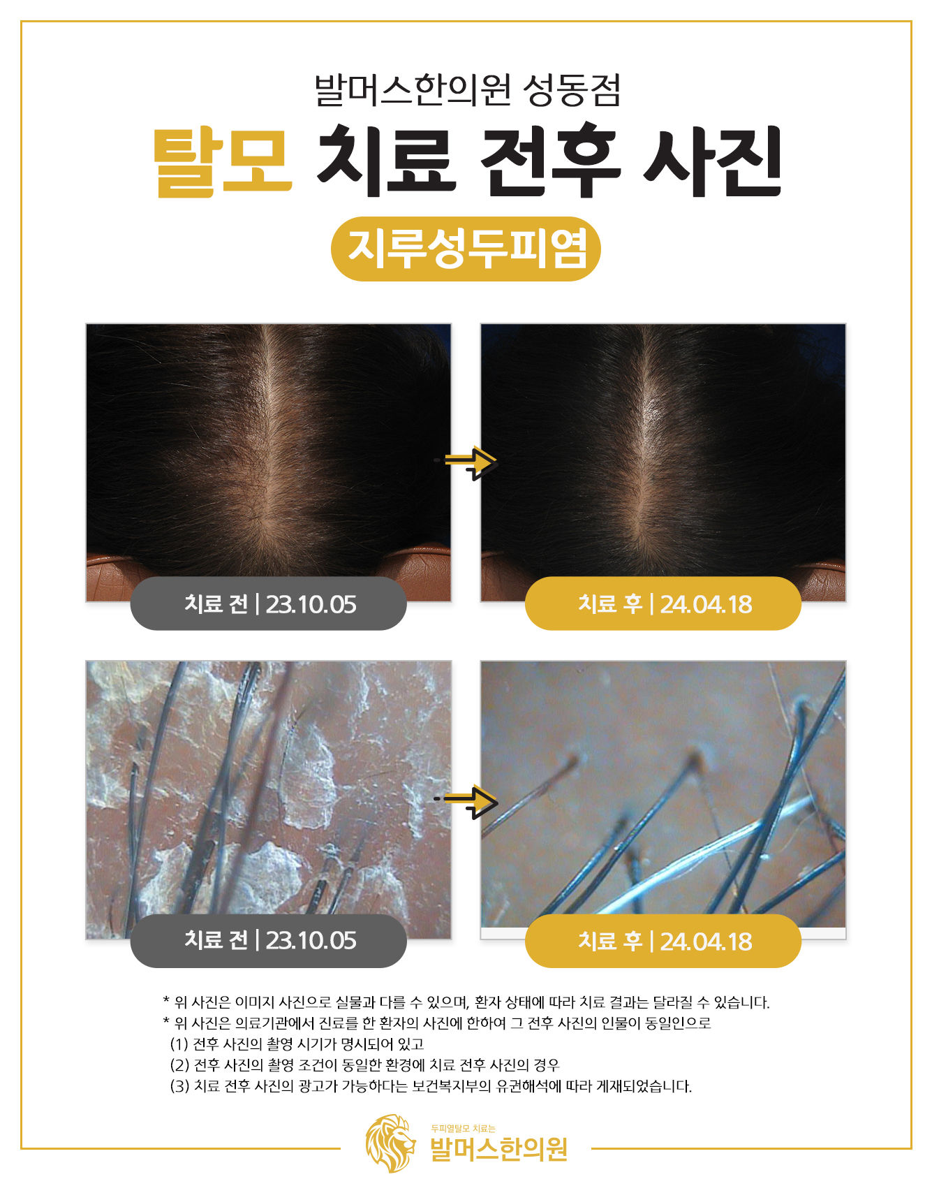 발머스한의원 종로성동 대표 이미지