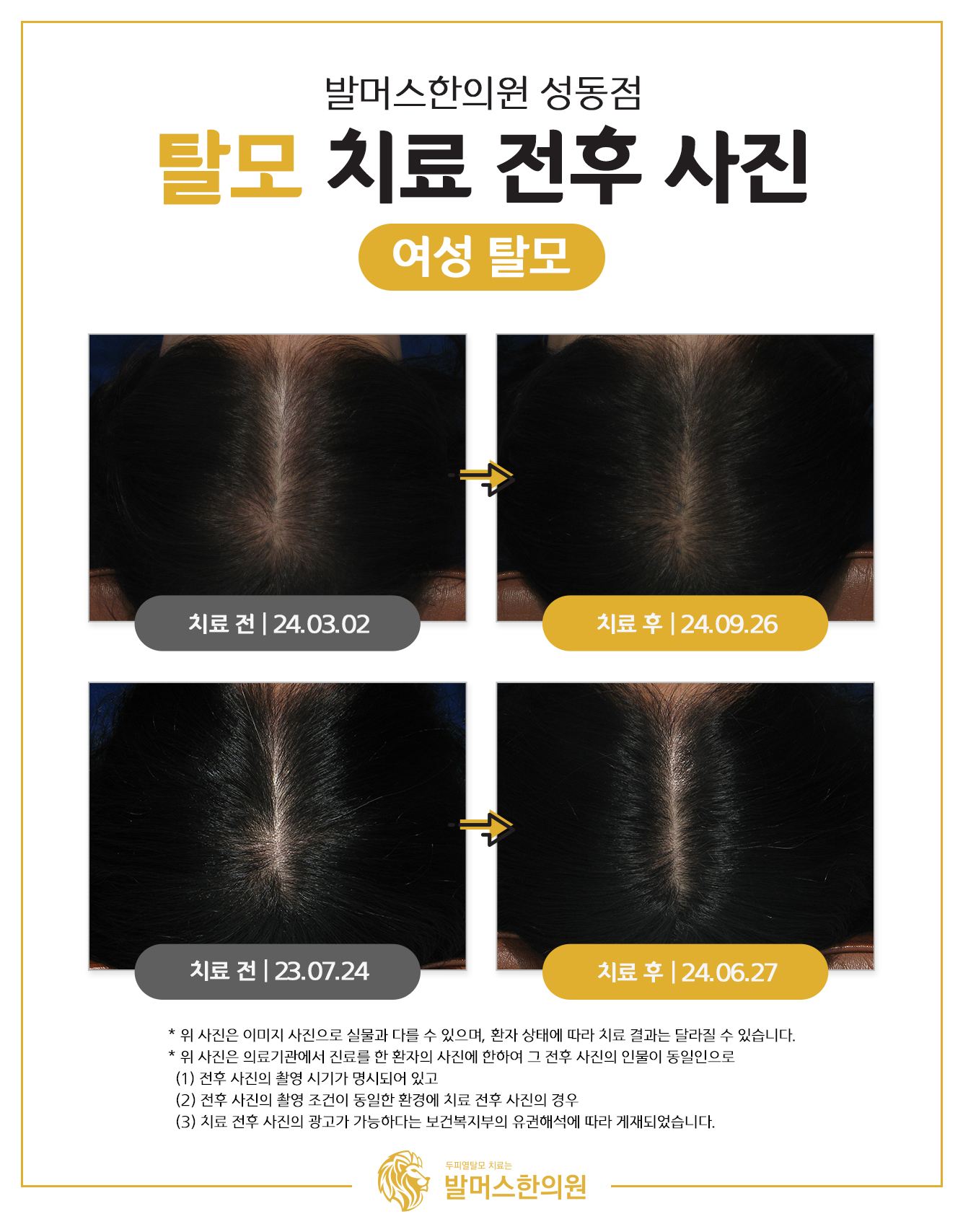 발머스한의원 종로성동 대표 이미지