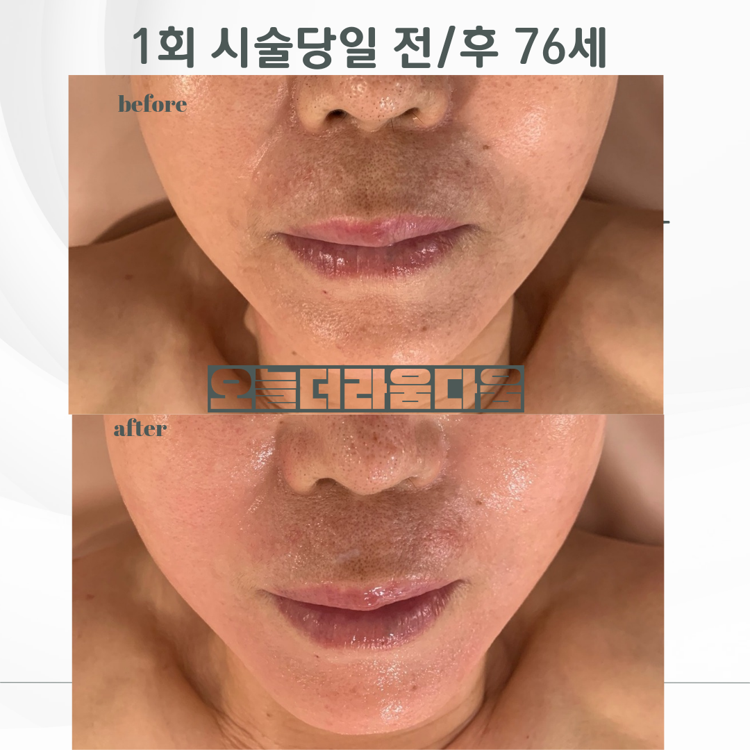 오늘 더 라움다움